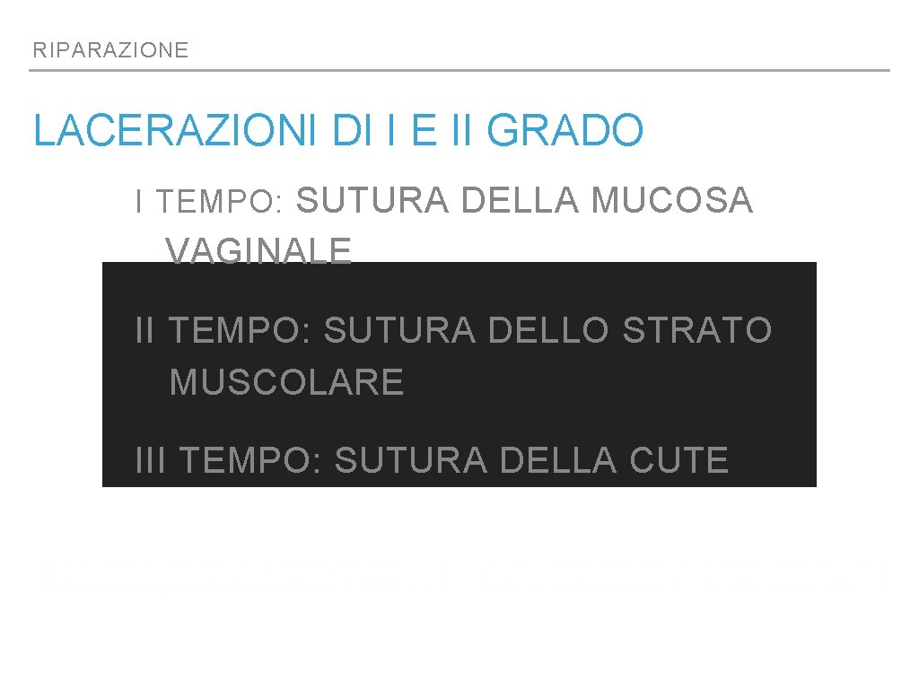 RIPARAZIONE LACERAZIONI DI I E II GRADO I TEMPO: SUTURA DELLA MUCOSA VAGINALE II