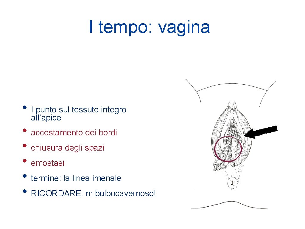 I tempo: vagina • I punto sul tessuto integro all’apice • accostamento dei bordi