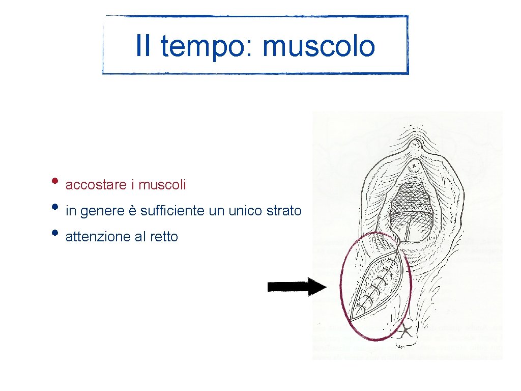 II tempo: muscolo • accostare i muscoli • in genere è sufficiente un unico