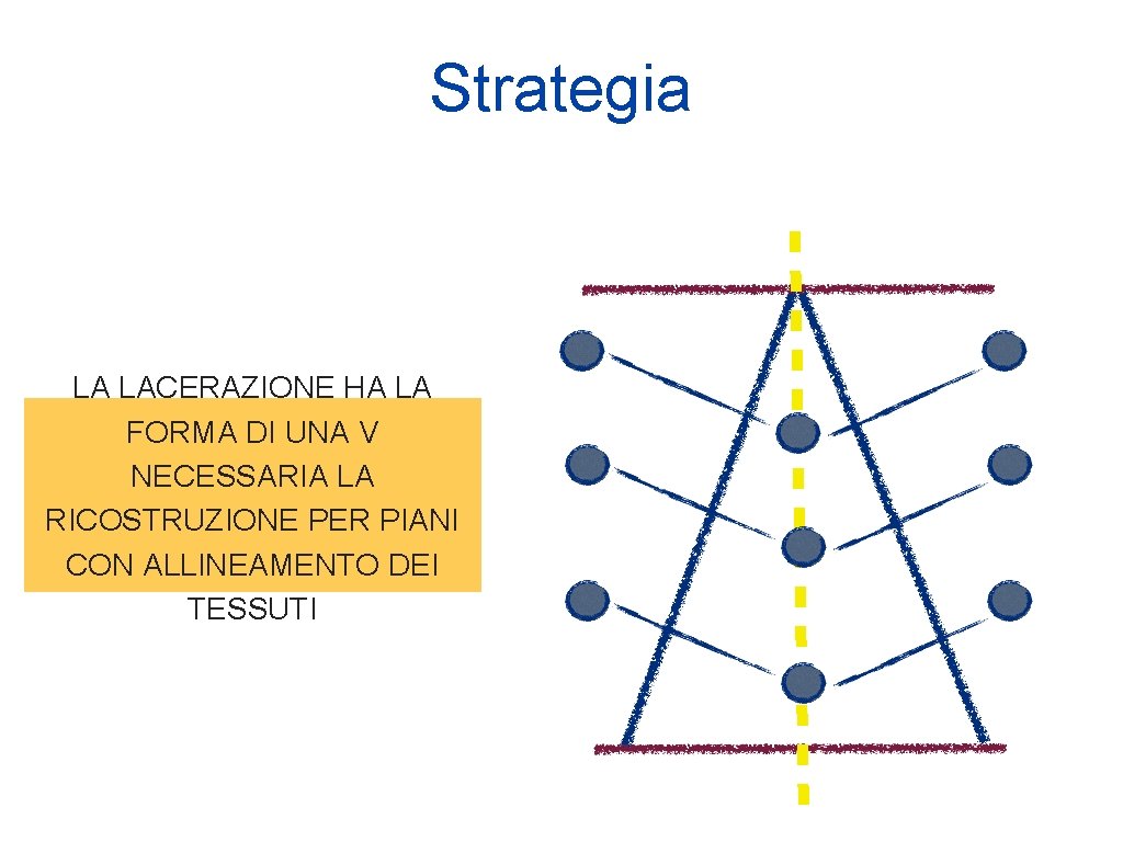 Strategia LA LACERAZIONE HA LA FORMA DI UNA V NECESSARIA LA RICOSTRUZIONE PER PIANI