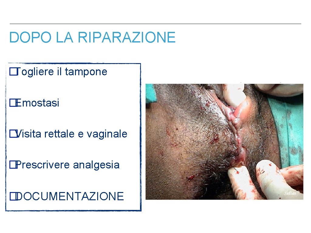 DOPO LA RIPARAZIONE �Togliere il tampone �Emostasi �Visita rettale e vaginale �Prescrivere analgesia �DOCUMENTAZIONE