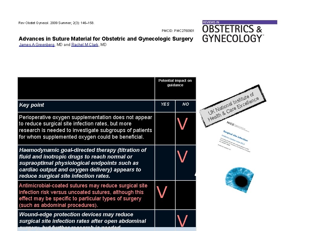 Rev Obstet Gynecol. 2009 Summer; 2(3): 146– 158. PMCID: PMC 2760901 Advances in Suture