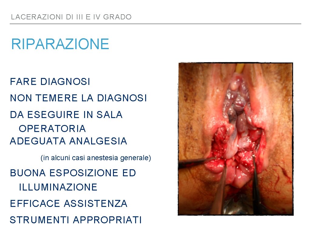 LACERAZIONI DI III E IV GRADO RIPARAZIONE FARE DIAGNOSI NON TEMERE LA DIAGNOSI DA