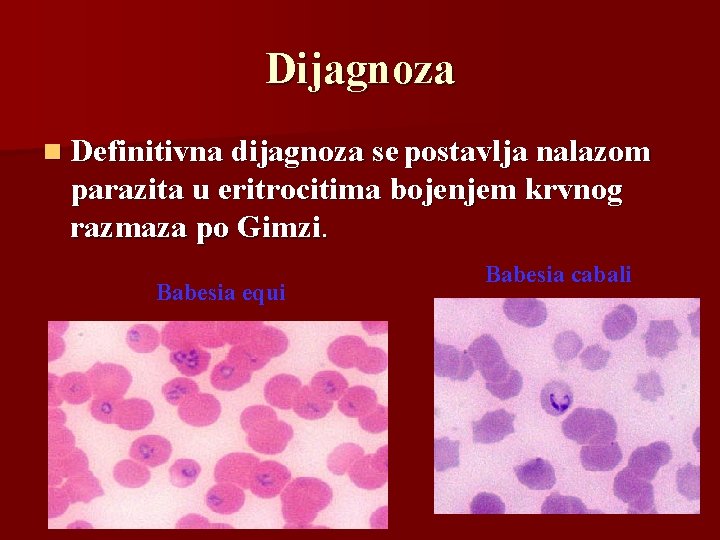 Dijagnoza n Definitivna dijagnoza se postavlja nalazom parazita u eritrocitima bojenjem krvnog razmaza po