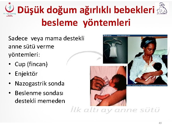 Düşük doğum ağırlıklı bebekleri besleme yöntemleri Sadece veya mama destekli anne sütü verme yöntemleri: