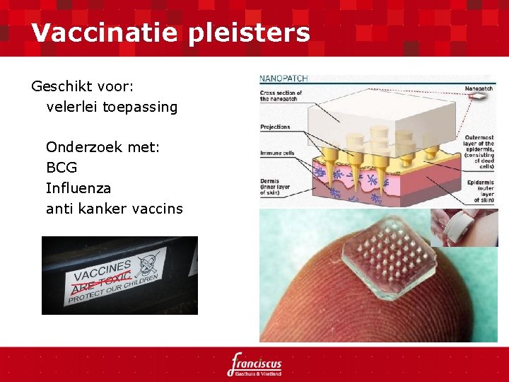 Vaccinatie pleisters Geschikt voor: velerlei toepassing Onderzoek met: BCG Influenza anti kanker vaccins 