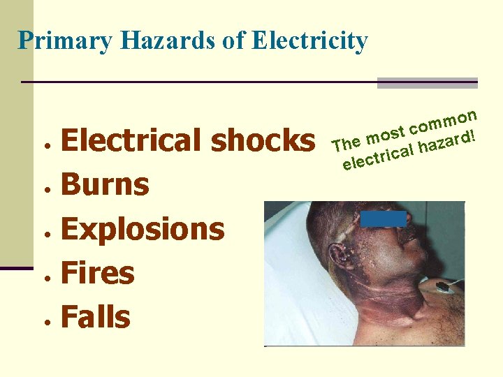 Primary Hazards of Electricity Electrical shocks • Burns • Explosions • Fires • Falls