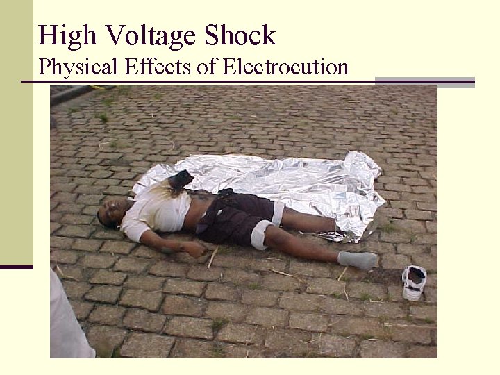 High Voltage Shock Physical Effects of Electrocution 