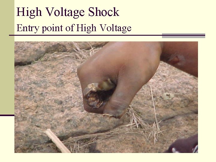 High Voltage Shock Entry point of High Voltage 