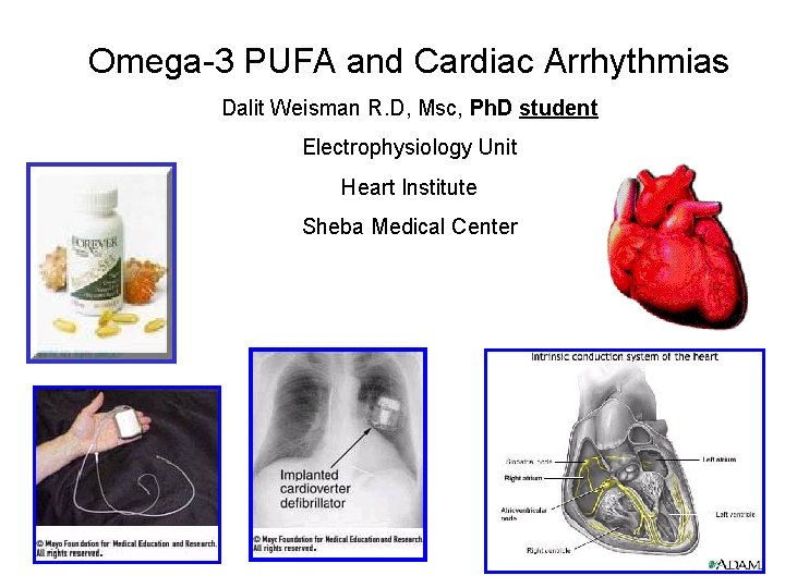 Omega-3 PUFA and Cardiac Arrhythmias Dalit Weisman R. D, Msc, Ph. D student Electrophysiology
