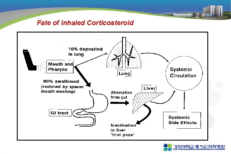 Fate of Inhaled Corticosteroid 