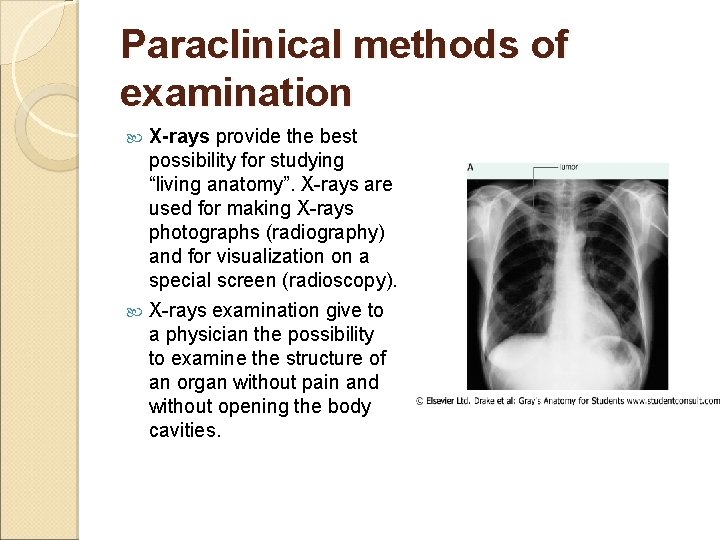 Paraclinical methods of examination X-rays provide the best possibility for studying “living anatomy”. X-rays