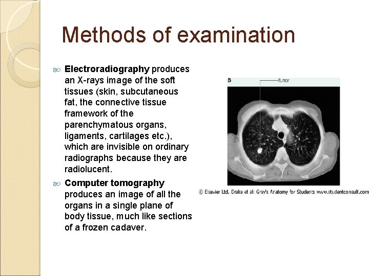 Methods of examination Electroradiography produces an X-rays image of the soft tissues (skin, subcutaneous