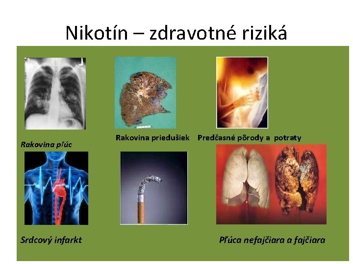 Nikotín – zdravotné riziká Rakovina pľúc Srdcový infarkt Rakovina priedušiek Predčasné pôrody a potraty