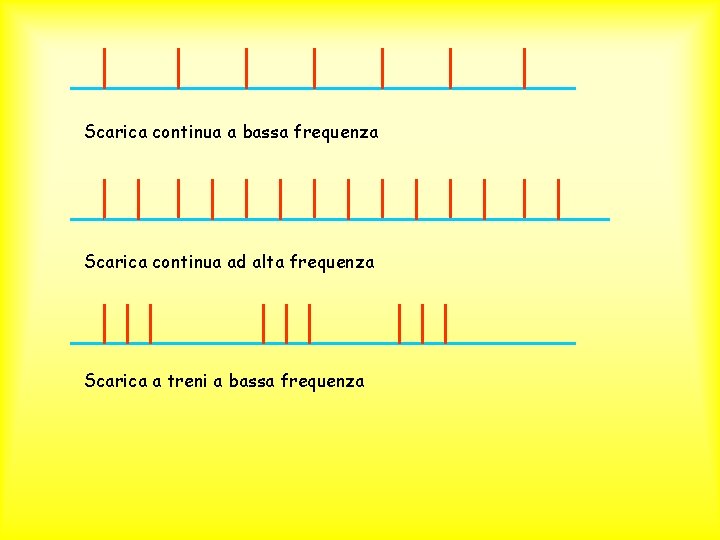 Scarica continua a bassa frequenza Scarica continua ad alta frequenza Scarica a treni a