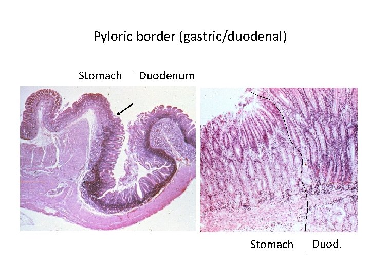 Pyloric border (gastric/duodenal) Stomach Duodenum Stomach Duod. 