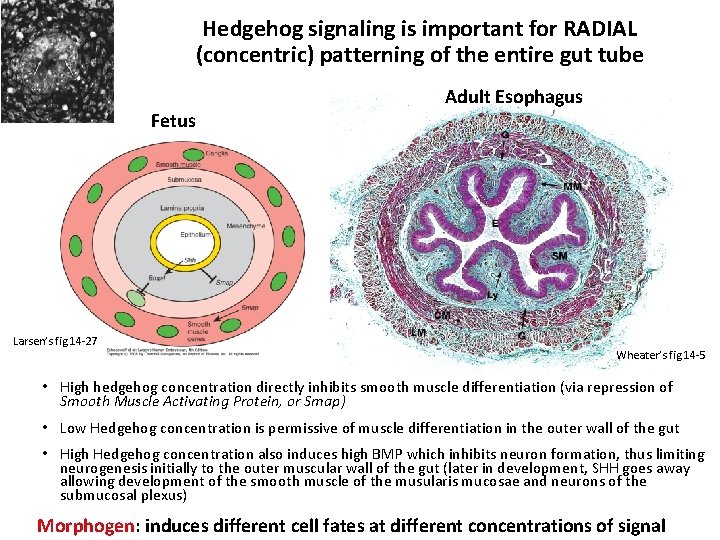 Hedgehog signaling is important for RADIAL (concentric) patterning of the entire gut tube Fetus