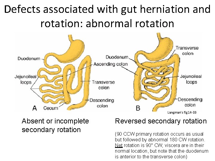 Defects associated with gut herniation and rotation: abnormal rotation Langman’s fig 14 -33 Absent