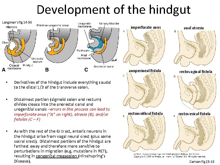 Development of the hindgut Langman’s fig 14 -36 imperforate anus • Derivatives of the