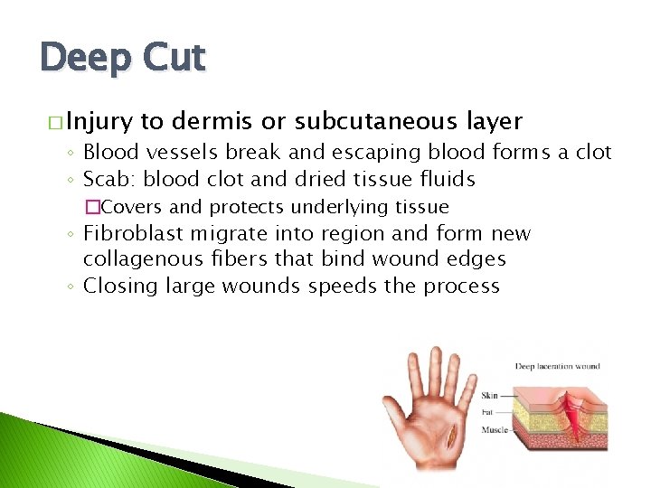 Deep Cut � Injury to dermis or subcutaneous layer ◦ Blood vessels break and Deep Cut � Injury to dermis or subcutaneous layer ◦ Blood vessels break and