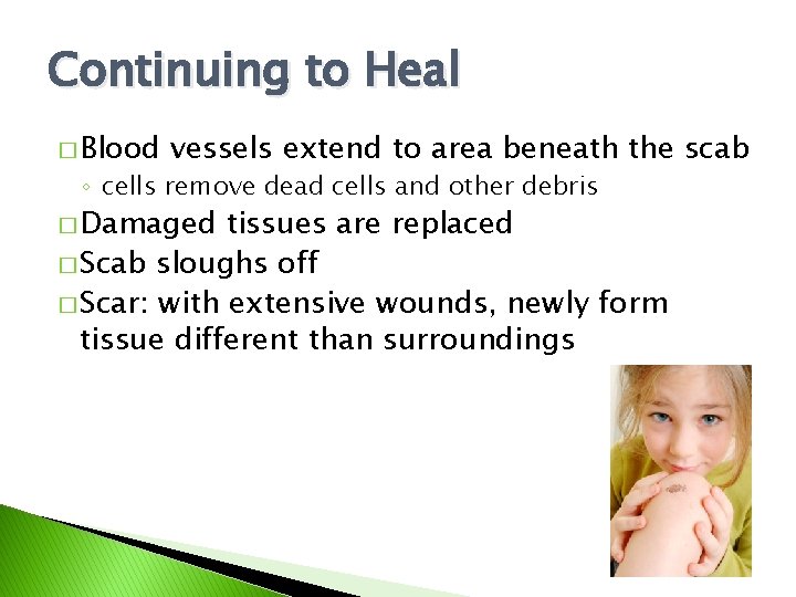 Continuing to Heal � Blood vessels extend to area beneath the scab ◦ cells Continuing to Heal � Blood vessels extend to area beneath the scab ◦ cells