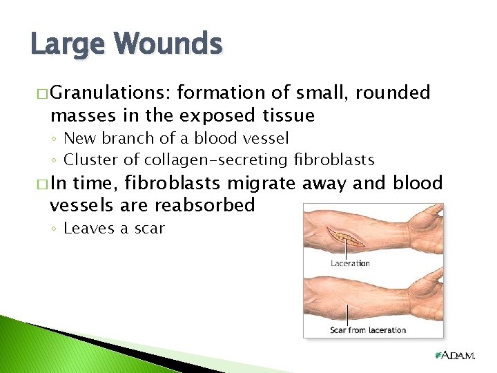 Large Wounds � Granulations: formation of small, rounded masses in the exposed tissue ◦