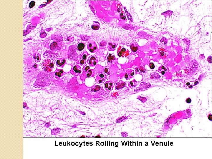 Leukocytes Rolling Within a Venule 