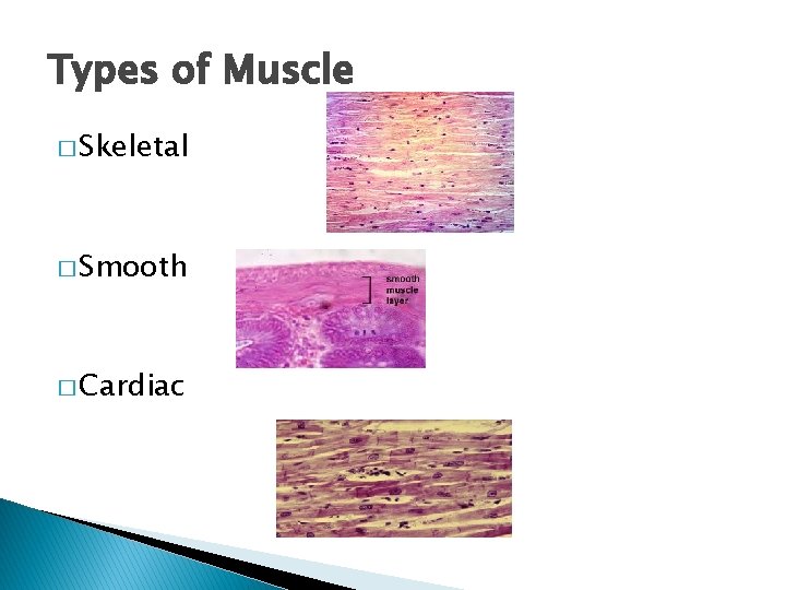 Types of Muscle � Skeletal � Smooth � Cardiac 