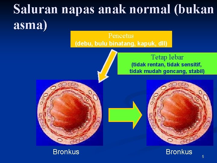 Saluran napas anak normal (bukan asma) Pencetus (debu, bulu binatang, kapuk, dll) Tetap lebar