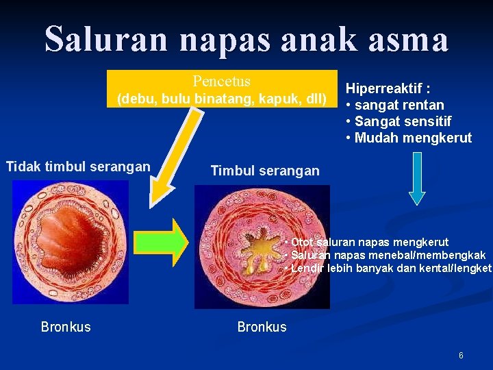 Saluran napas anak asma Pencetus (debu, bulu binatang, kapuk, dll) Tidak timbul serangan Hiperreaktif