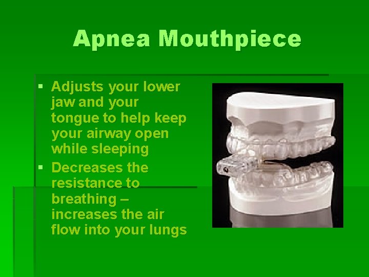 Apnea Mouthpiece § Adjusts your lower jaw and your tongue to help keep your