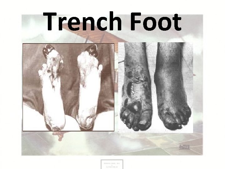 TRENCH WARFARE WWI Trench Warfare Trench Warfare Trench