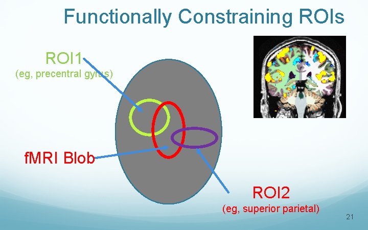 Functionally Constraining ROIs ROI 1 (eg, precentral gyrus) f. MRI Blob ROI 2 (eg,