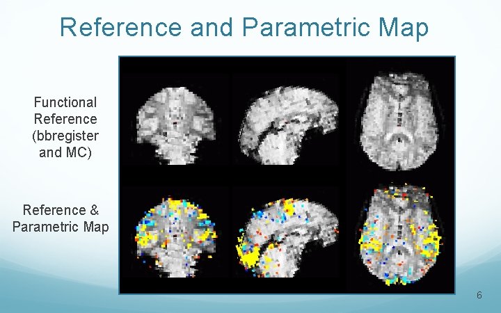 Reference and Parametric Map Functional Reference (bbregister and MC) Reference & Parametric Map 6