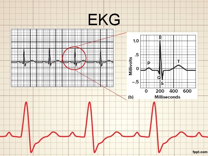 EKG 