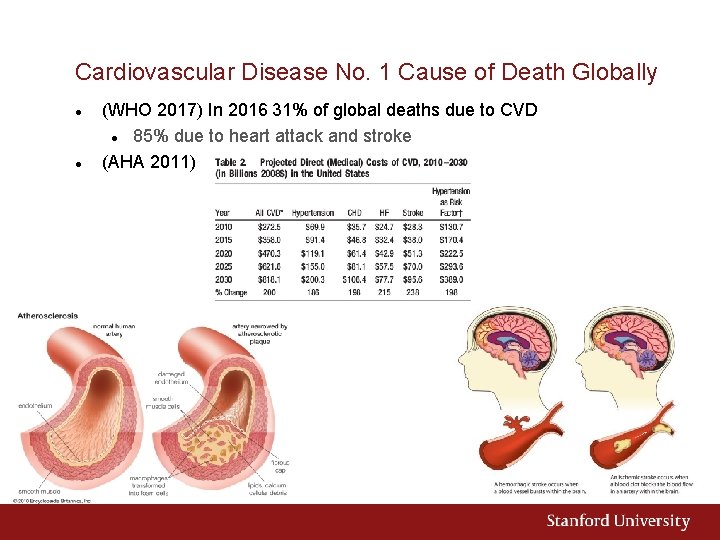 Cardiovascular Disease No. 1 Cause of Death Globally (WHO 2017) In 2016 31% of