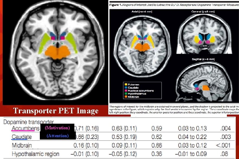 Transporter PET Image (Motivation) (Attention) 