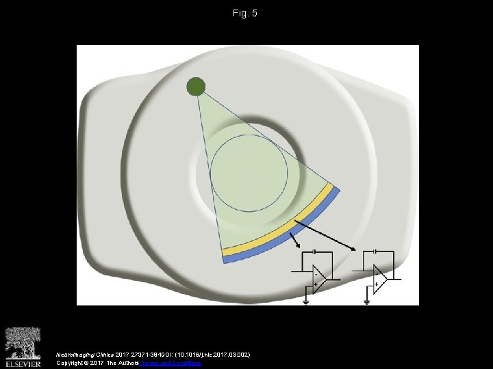 Fig. 5 Neuroimaging Clinics 2017 27371 -384 DOI: (10. 1016/j. nic. 2017. 03. 002)