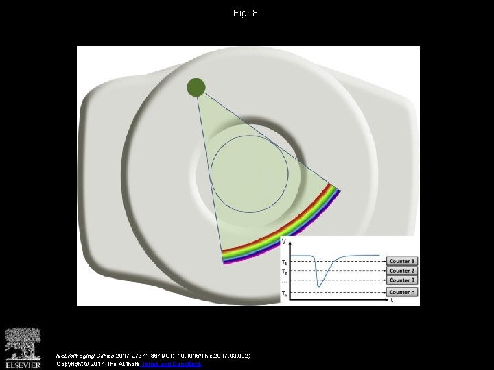 Fig. 8 Neuroimaging Clinics 2017 27371 -384 DOI: (10. 1016/j. nic. 2017. 03. 002)