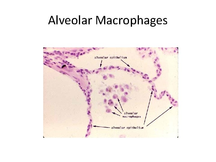 Alveolar Macrophages 