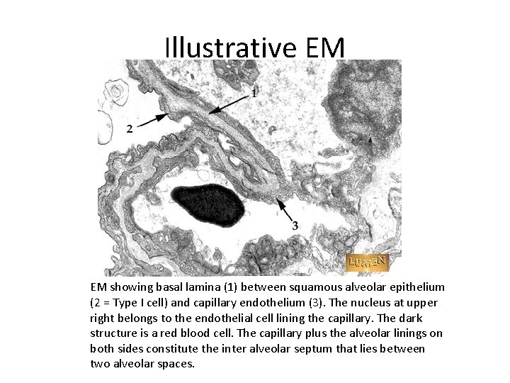 Illustrative EM EM showing basal lamina (1) between squamous alveolar epithelium (2 = Type