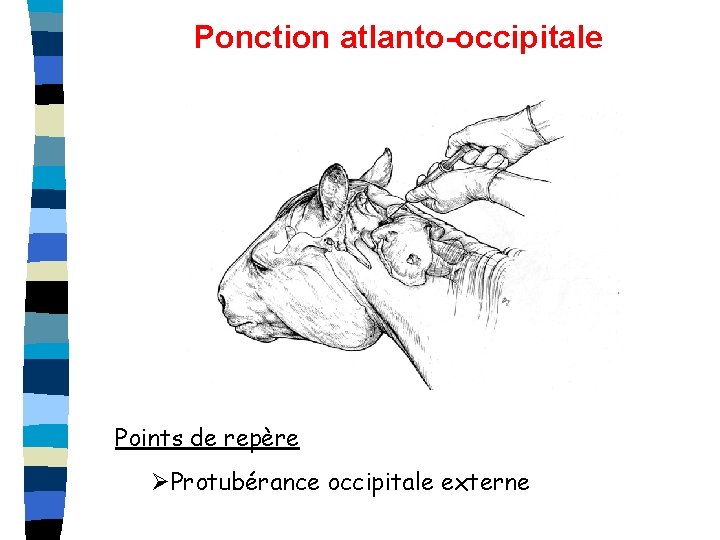 Ponction atlanto-occipitale Points de repère ØProtubérance occipitale externe 