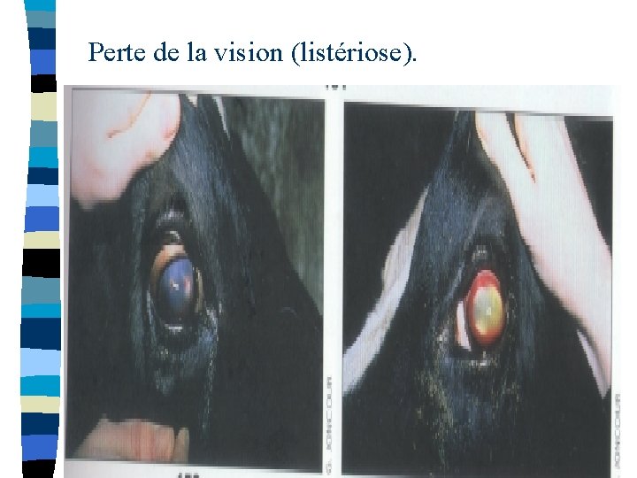 Perte de la vision (listériose). 