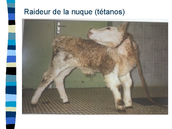 Raideur de la nuque (tétanos) 