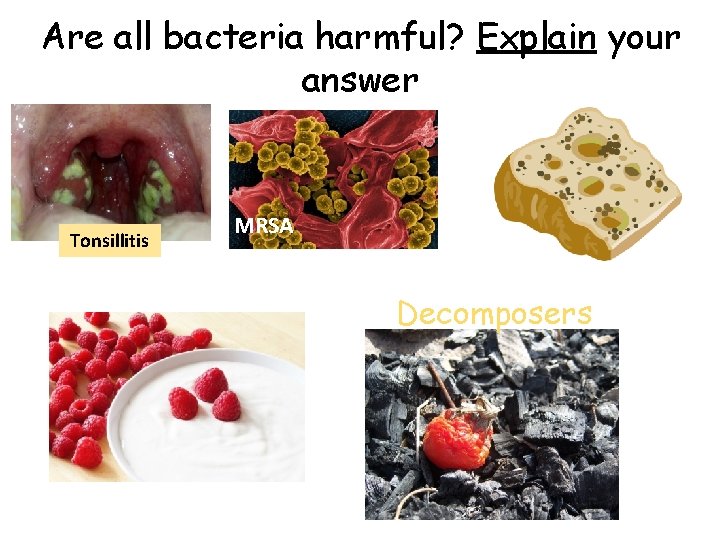 Are all bacteria harmful? Explain your answer Tonsillitis MRSA Decomposers 