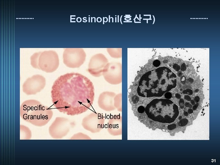 Eosinophil(호산구) 31 