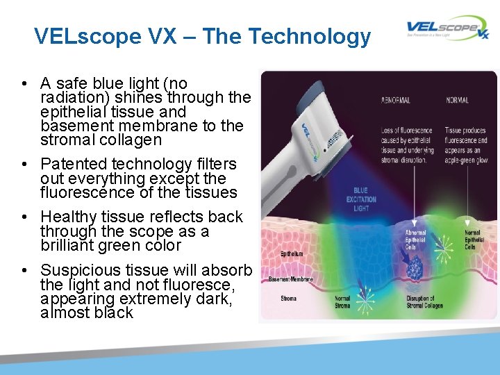 VELscope VX – The Technology • A safe blue light (no radiation) shines through