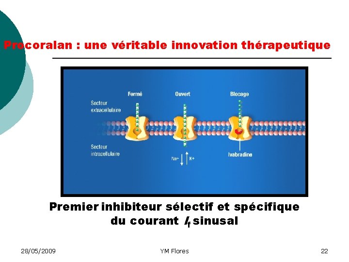 Procoralan : une véritable innovation thérapeutique Fermé Ouvert Inhibition sélective du canal If K+