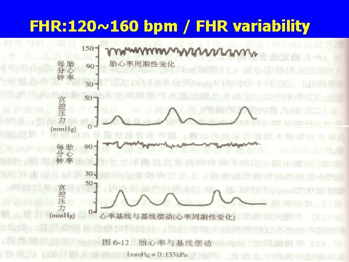 FHR: 120~160 bpm / FHR variability 