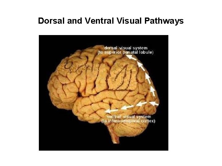 Dorsal and Ventral Visual Pathways 